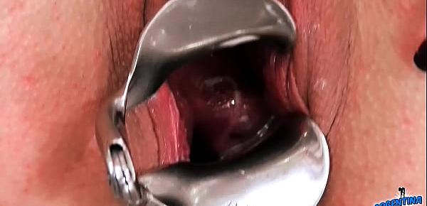  Peehole Fingering Peehole Gaping Pussy Stretching Cervix